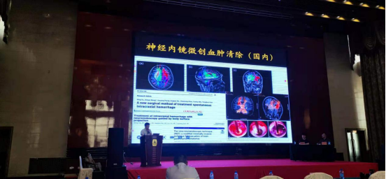 【萊沃醫(yī)療】熱烈慶祝中國神經內鏡微創(chuàng)治療高血壓腦出血技術推廣會順利召開